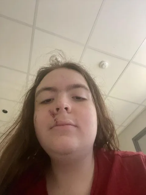 Almost got stabbed to death by a family member