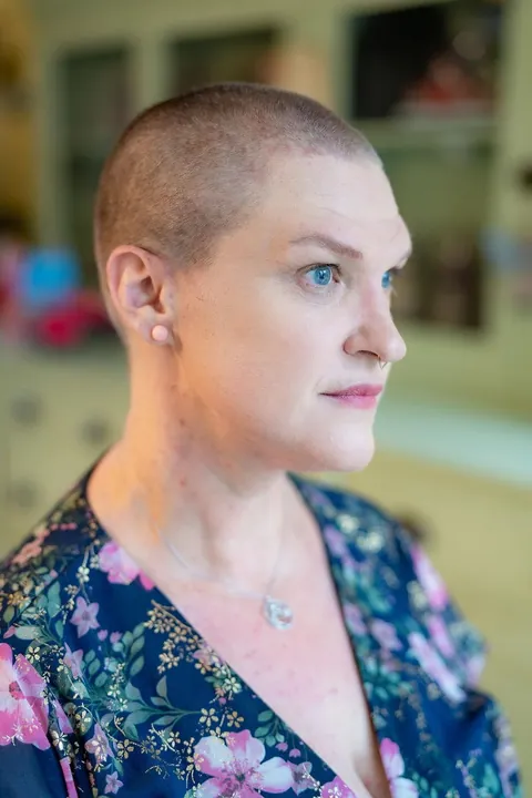 Shaving my head after week one of chemo
