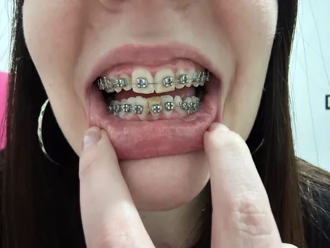 Thread to show my progress: 1 month :)