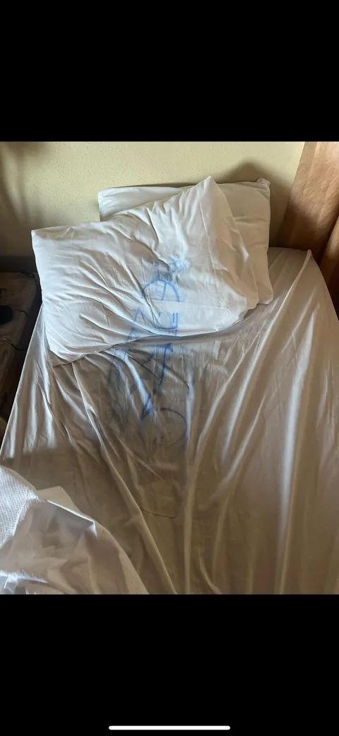 My buddy drew a dick on my back in sharpie while we were at a hotel in mexico, this is what i woke up to.