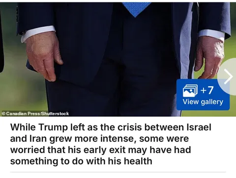 Felony President’s hands are back in the news