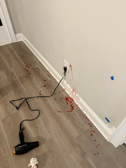 My dogs are trying to kill me…