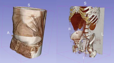 I requested the raw data of my MRI scans from my medical records to play around with at home using freely available open source software