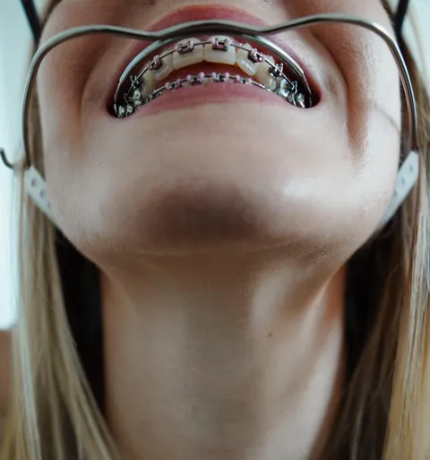 Smiling as big as I can! Do you approve?