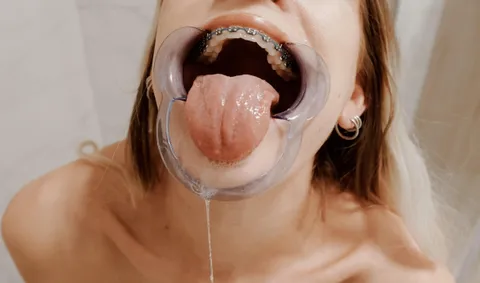 Stole a cheek spreader from my orthodontist’s office during my last appointment 🤫