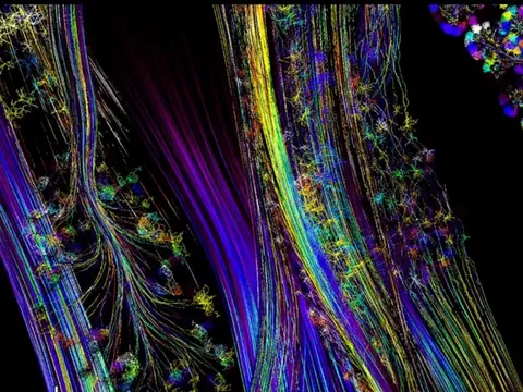 BRAINSTEM TRANSITIONING INTO SPINAL CORD