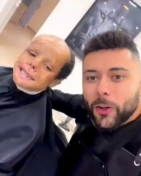Kind Barber Gives a Young Burn Victim Hair