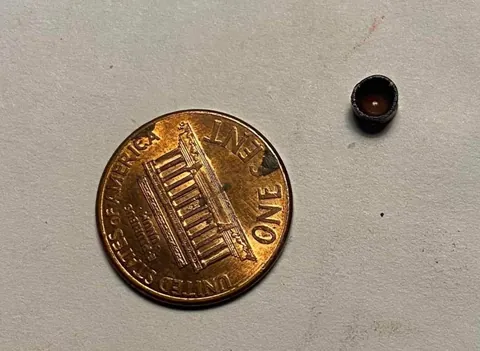 Friends cig exploded cartoon style and this was lodged in her lip