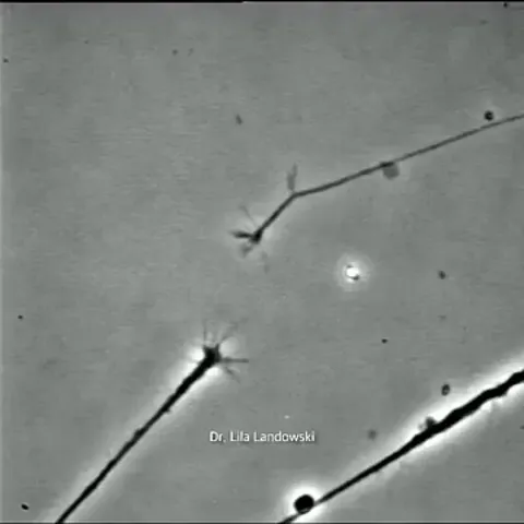 Neurons trying to connect to each other 