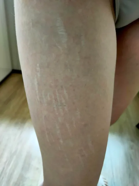 Scar tattoo cover ups (by me @karolinaszymanska_tattoo from Poland) 🌸